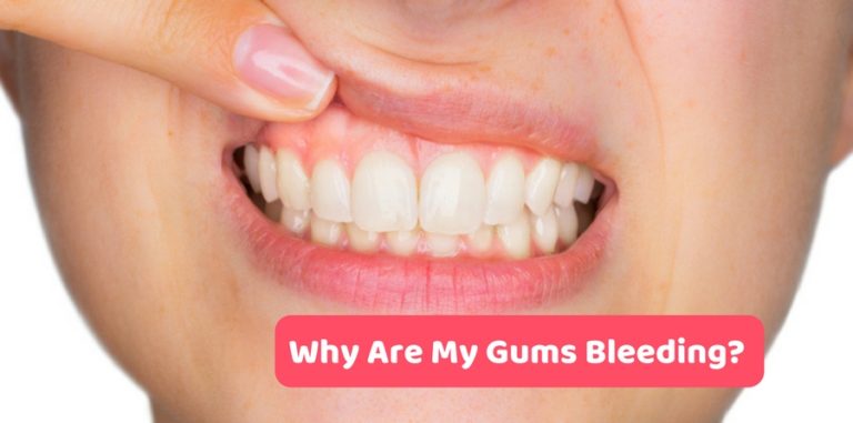 why-are-my-gums-bleeding-cotton-creek-dental